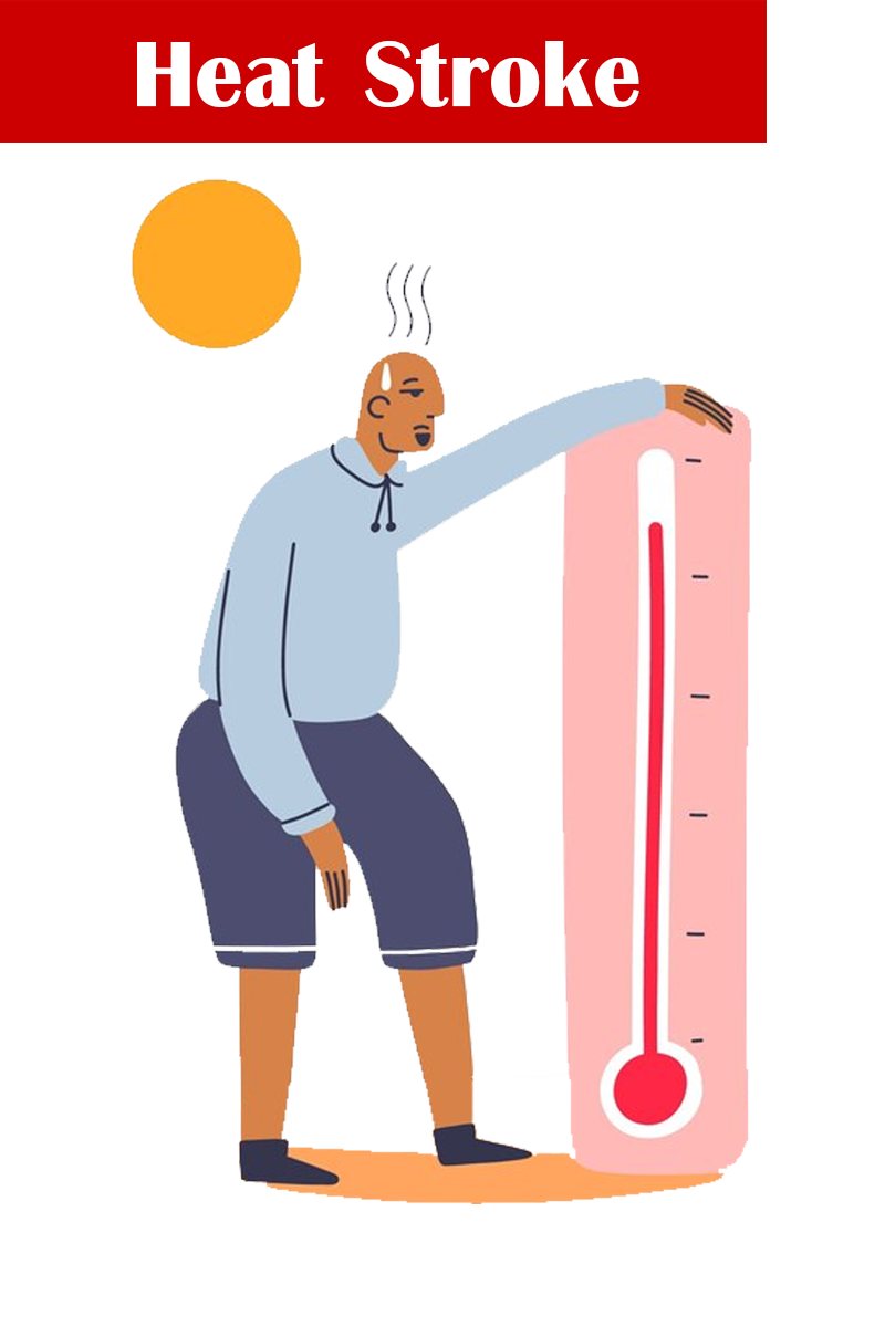 โรคลมแดด (Heat Stroke)